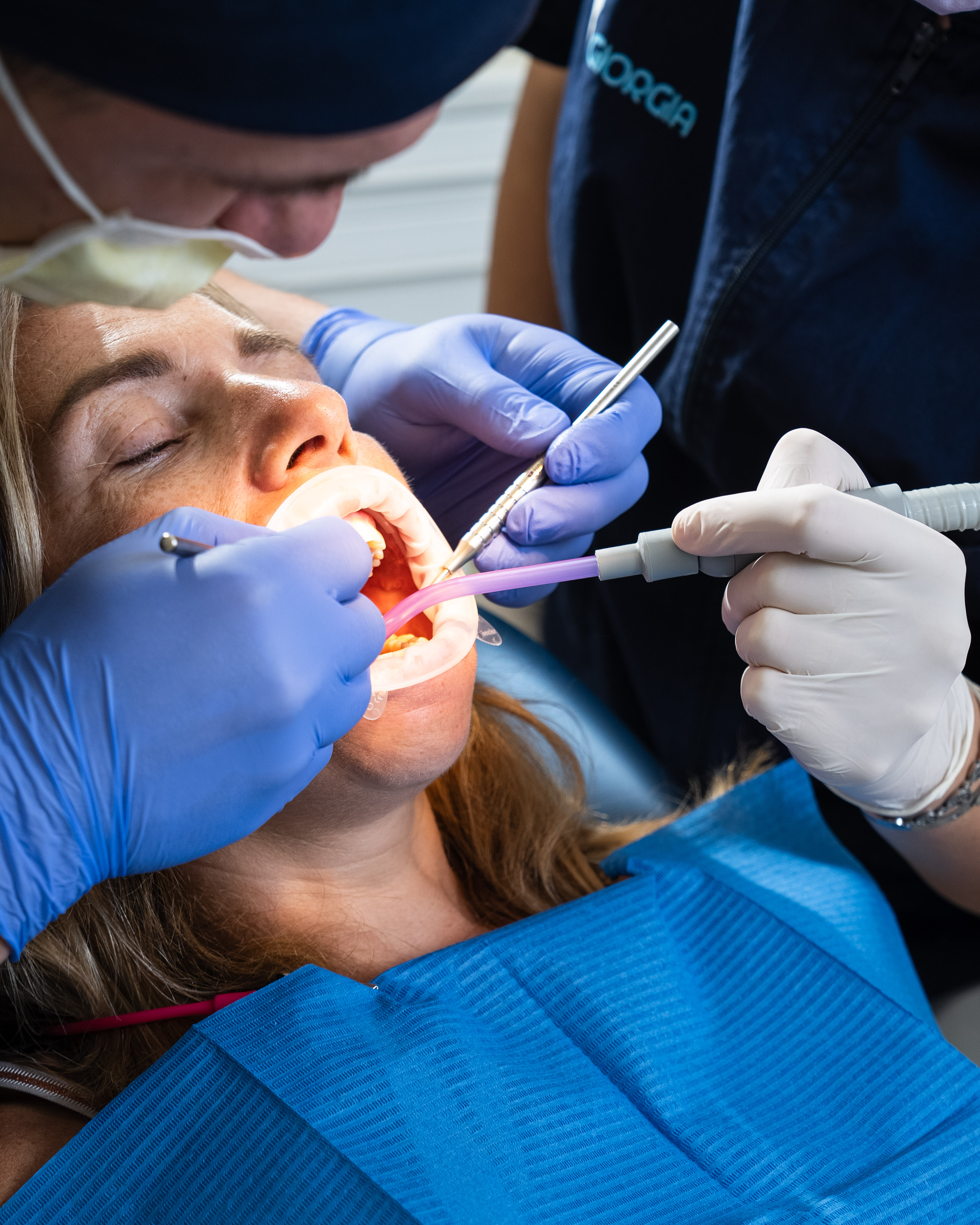 Igiene Orale - Top Dental Torino